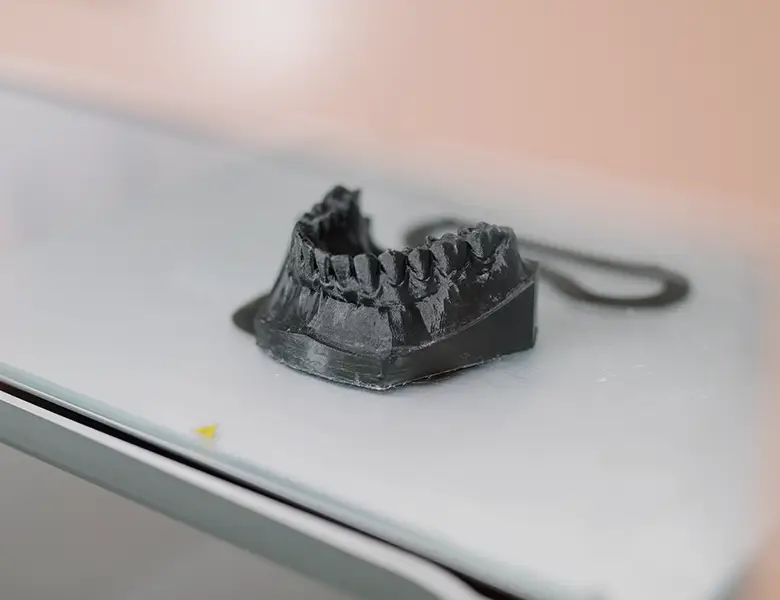 Zahnersatz Implantate: Mund-Kiefer-Gesichtschirurgie in Regensburg